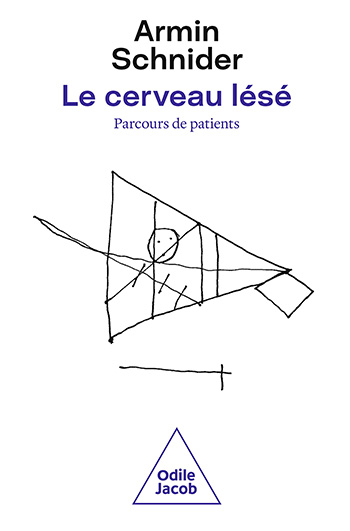 Cerveau lésé (Le) - Parcours de patients : fonctions atteintes et récupération